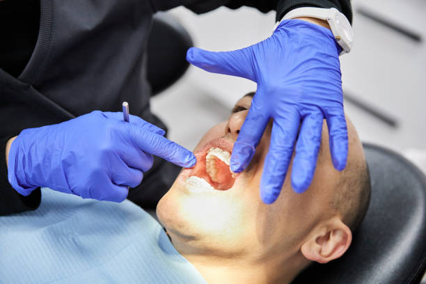Best Emergency Wisdom Teeth Removal in Natalia, TX